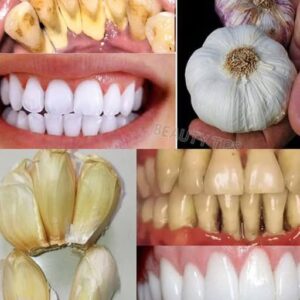 Improve Your Oral Health Naturally with Garlic Improve Your Oral Health Naturally with Garlic